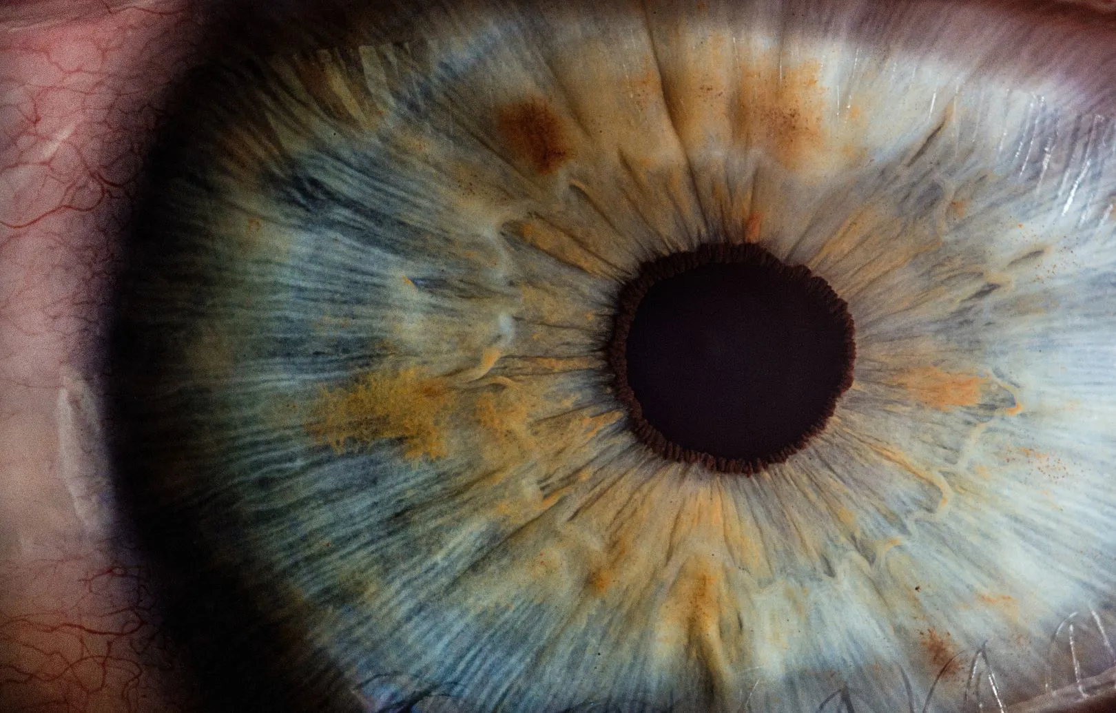 Iridologia, la diagnosi arriva dagli occhi