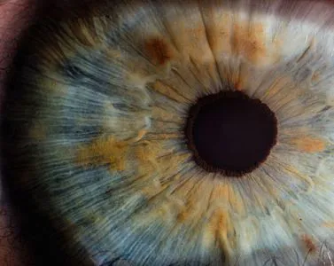 Iridologia, la diagnosi arriva dagli occhi