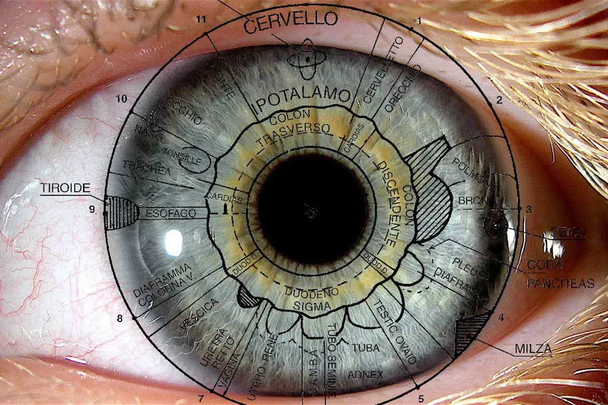 Operatore di Iridologia